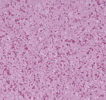 Линолеум Mipolam Affinity 4482 Orchid фото 1 | FLOORDEALER